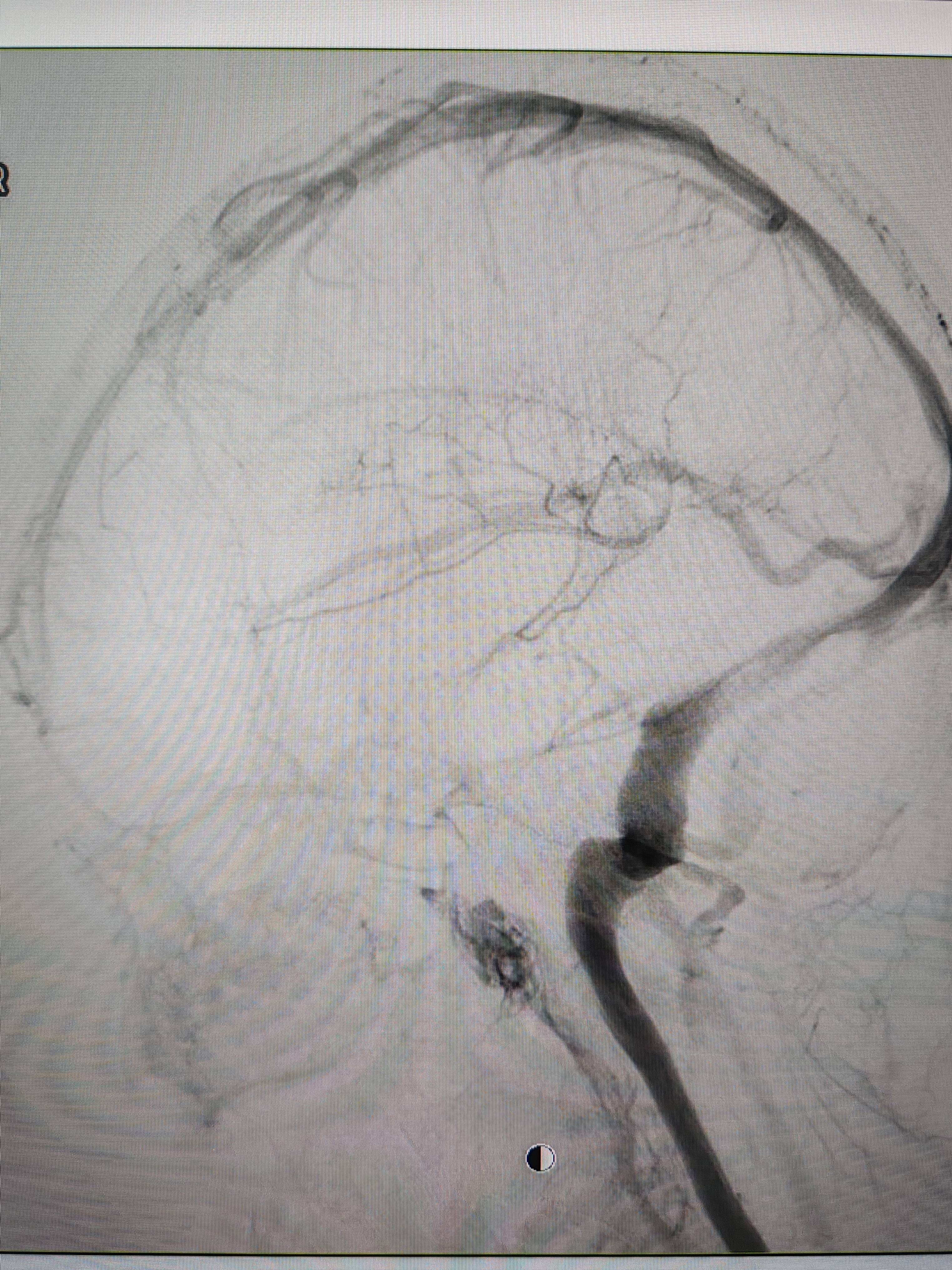 吉林女子患罕见耳鸣7年<strong></p>
<p>初入币圈</strong>，慕名千里来顺德寻医终获新生
