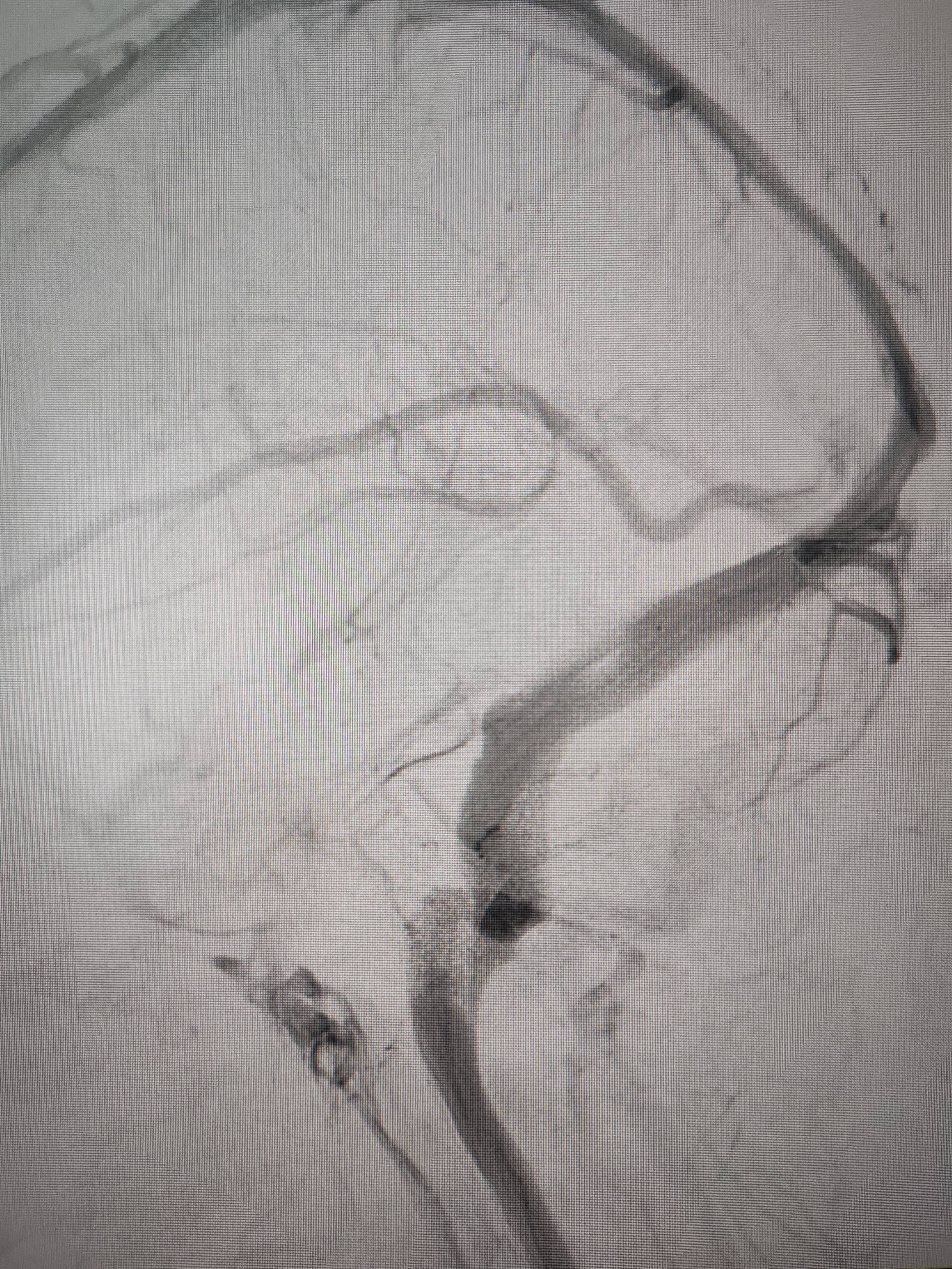 吉林女子患罕见耳鸣7年<strong></p>
<p>初入币圈</strong>，慕名千里来顺德寻医终获新生