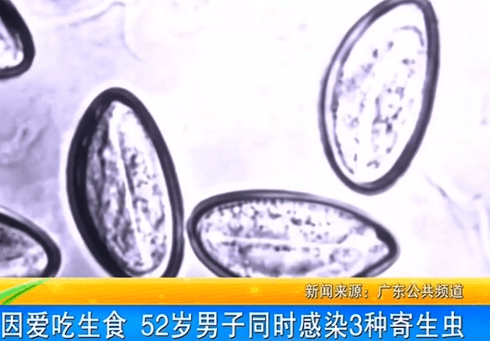 女子体内排出10米长绦虫<strong></p>
<p>炒币破产</strong>！原是两年前旅游时吃了这种食物