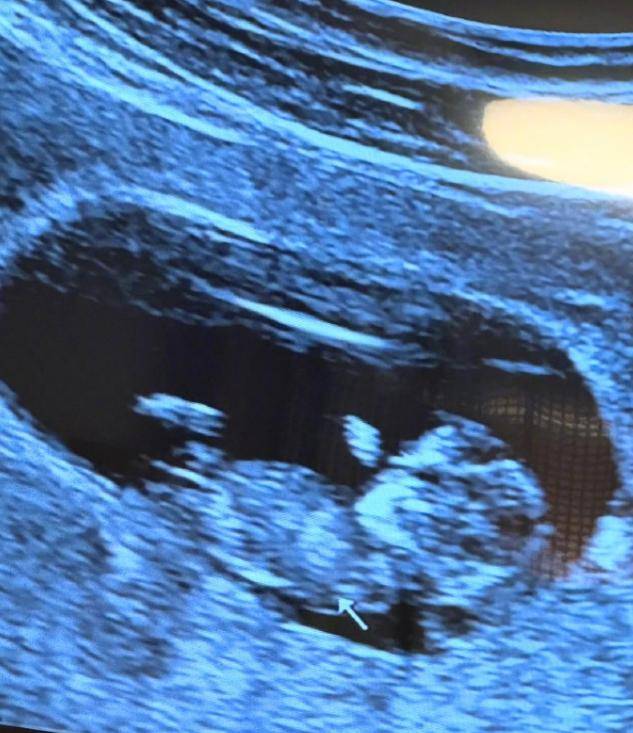 46岁知名女星宣布怀孕