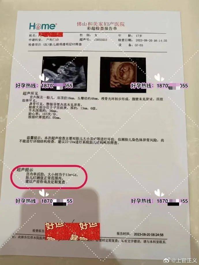 17岁彝族少女被曝为50岁男子代孕<strong></p>
<p>烙印币</strong>，今年2月产下双胞胎