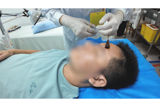 醒来“天塌了”<strong></p>
<p>嘉信c币</strong>！深圳一女子眼睛闭不上、嘴巴漏水！这些错误很多人会犯