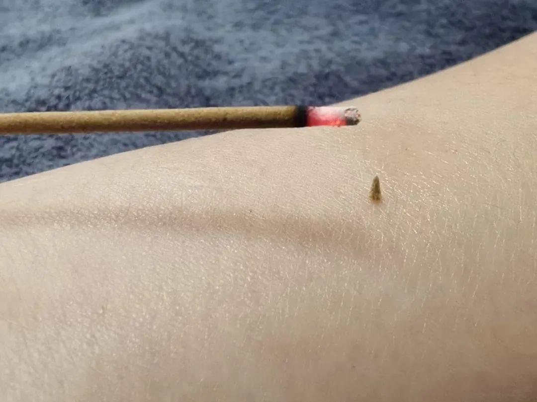 醒来“天塌了”<strong></p>
<p>嘉信c币</strong>！深圳一女子眼睛闭不上、嘴巴漏水！这些错误很多人会犯