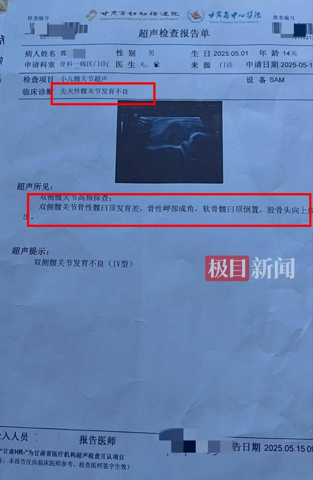 二胎出生查出先天性病症或落下残疾<strong></p>
<p>币圈视频</strong>，残疾父母称医院产检漏检、未尽告知义务，医院及医调委回应