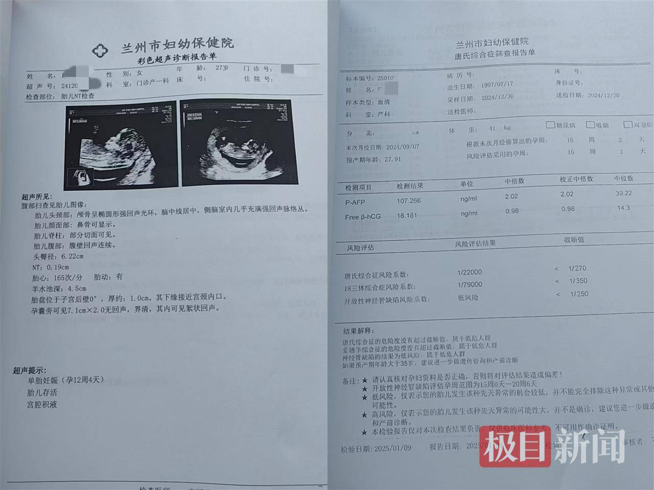 二胎出生查出先天性病症或落下残疾<strong></p>
<p>币圈视频</strong>，残疾父母称医院产检漏检、未尽告知义务，医院及医调委回应