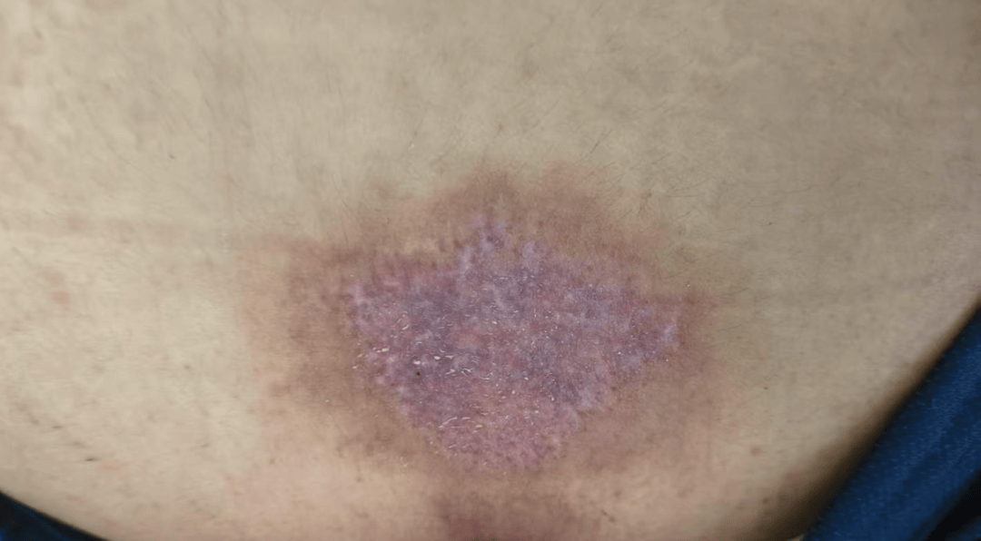 14岁女孩在拓展营遭体罚去世<strong></p>
<p>炒币砸盘的目的</strong>，班主任因截留其给父母信件受审