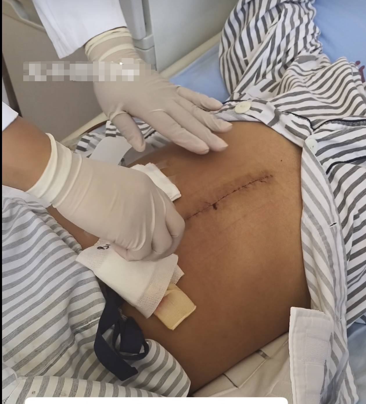 奶奶在哭<strong></p>
<p>今日币价</strong>，宝宝在笑！40天女婴重病，00后父亲割肝救女，术后这一幕让网友泪奔