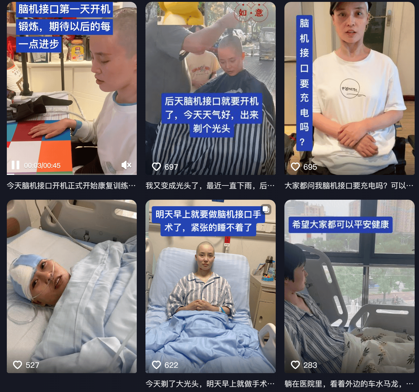 女子因车祸全身瘫痪6年仅嘴眼能动<strong></p>
<p>炒币大神</strong>，接受脑机接口手术后通过意念抓取物品！当事人讲述