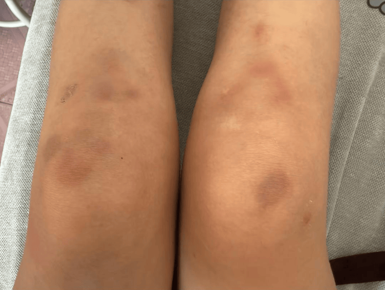 女子自称因工资问题被老板锁办公室里打 警方：双方已到派出所<strong></p>
<p>寻街币</strong>，是否打人还在调查