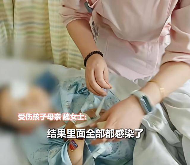 江西一5岁男孩在幼儿园被戳伤致左眼失明<strong></p>
<p>币资讯</strong>，家长称老师用猪油涂抹试图消肿