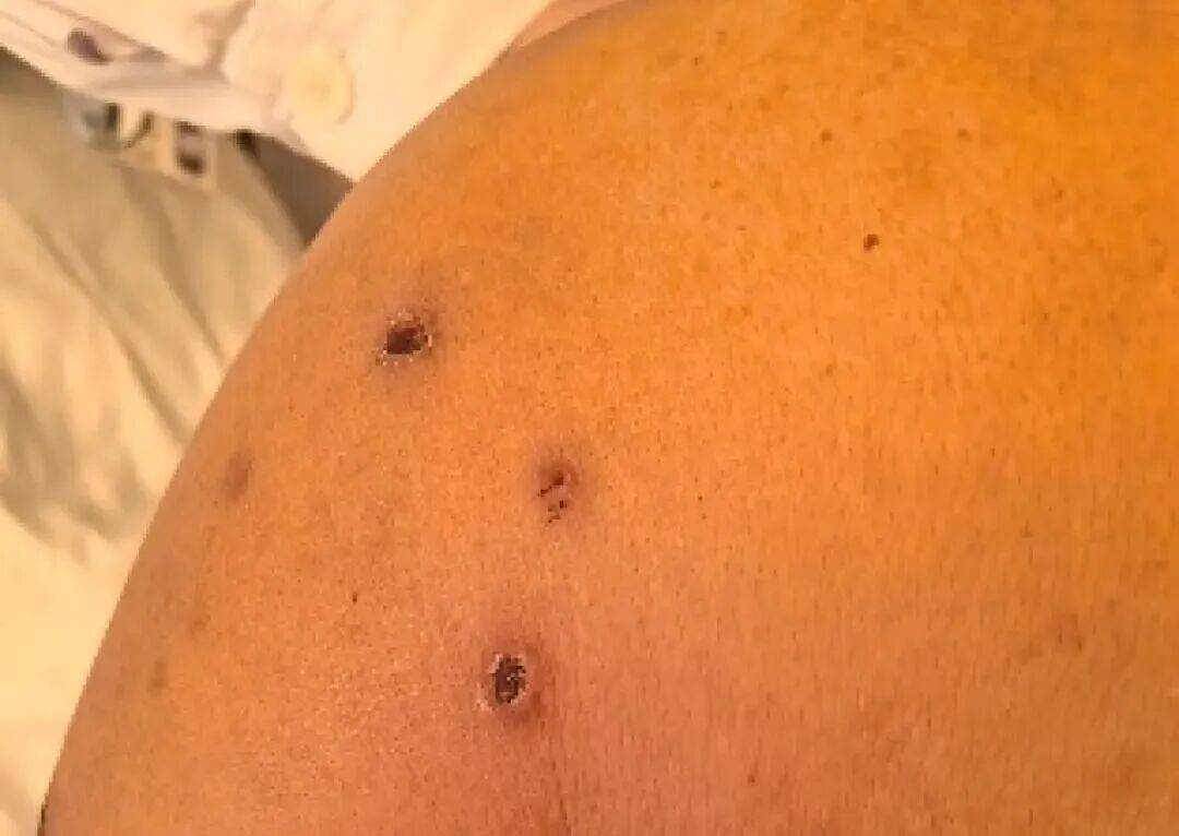 深圳一市民突遭马蜂围袭！已进入高发期<strong></p>
<p>币圈信息</strong>，千万别招惹！