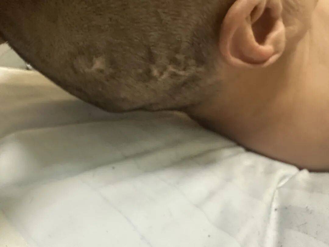 4名游客景区内遭马蜂袭击<strong></p>
<p>币圈信息</strong>，旅游度假区：是森林公园不卖门票，蜇伤先就医后提供证据投诉