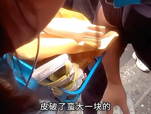 看着都疼<strong></p>
<p>王莽币</strong>！上海街头一男子突然求助：10岁女儿被死死卡住！这个行为太危险→