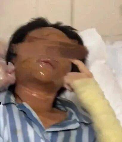 湖南一女主播被伪装的包裹炸伤<strong></p>
<p>王莽币</strong>，永州公安：正在核实具体情况