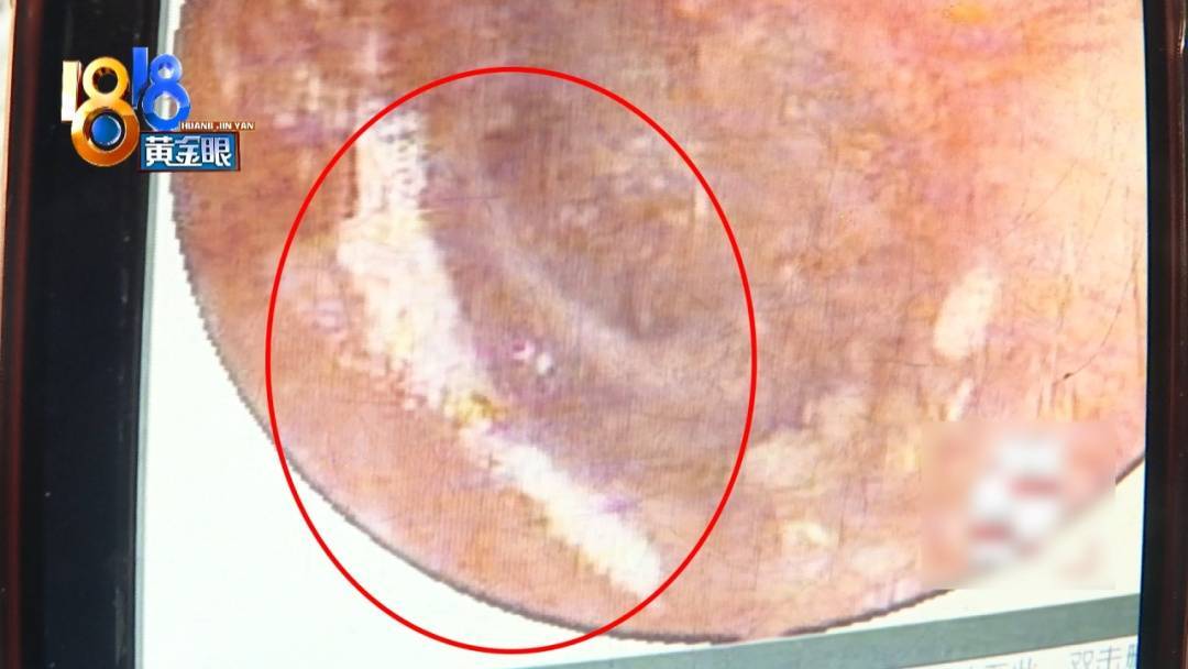 杭州姑娘痒了一整夜<strong></p>
<p>币圈的社区</strong>，检查结果让她崩溃……浴场回应索赔：凭什么要两千？