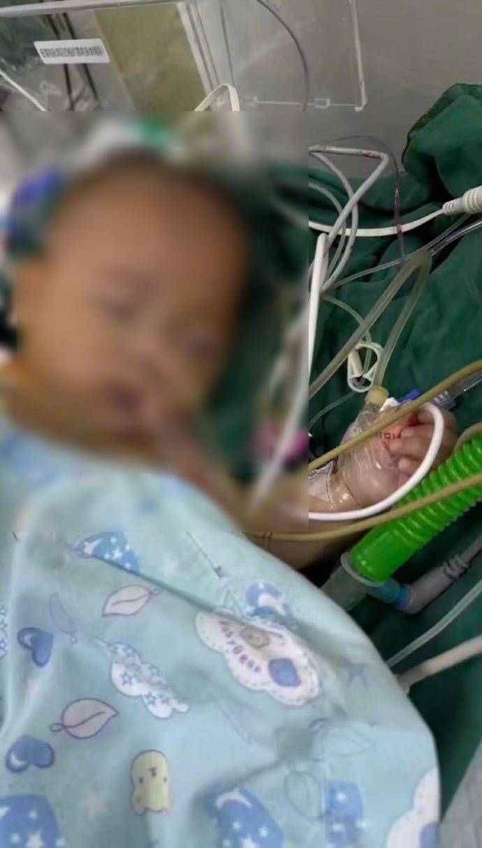 “小洛熙事件”涉事医院小儿胸心外科住院部已关闭<strong></p>
<p>币升值</strong>，胸心外科手术已暂停